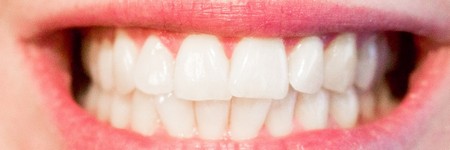 歯周病（歯槽膿漏）の症状とは？