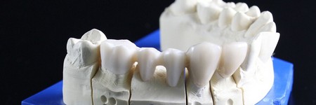 歯周病の対策方法