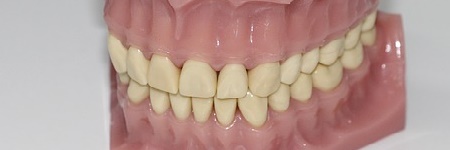 歯周病予防向け電動歯ブラシの選び方