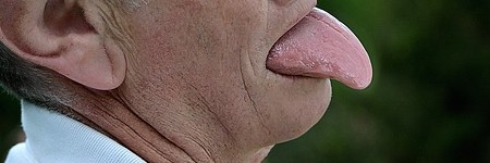 舌苔が出来る原因